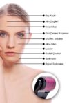 aiw-skin-roller-system-dermaroller-540-igne-g-364-3705.jpg